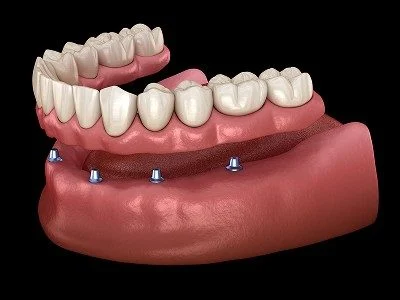 Image2