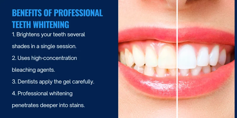 Benefits of Teeth whitening