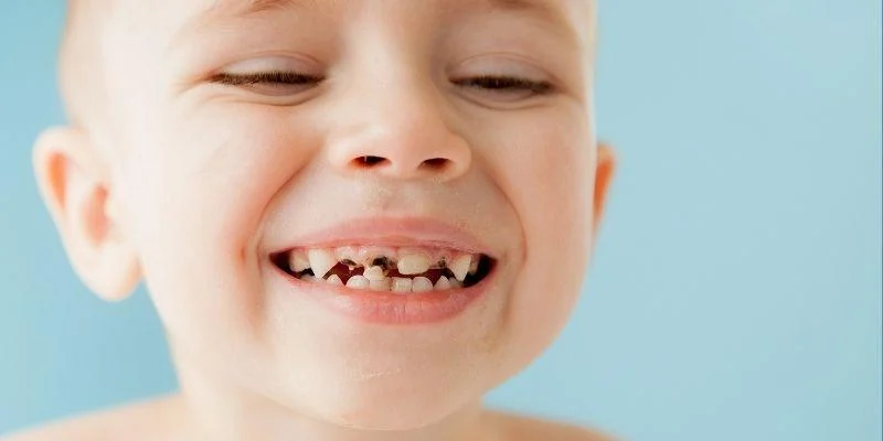 baby bottle tooth decay prevention