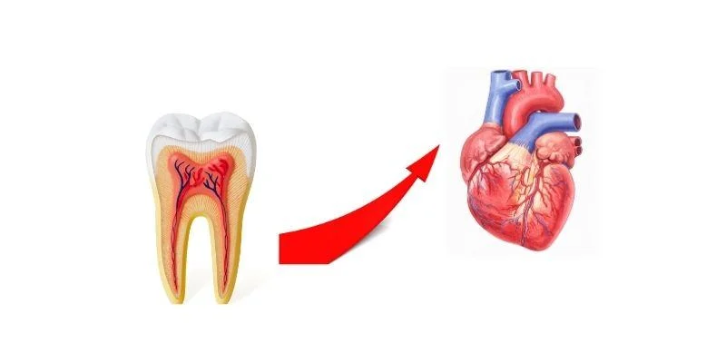 The Link Between Gum Disease and Heart Health: Key Facts