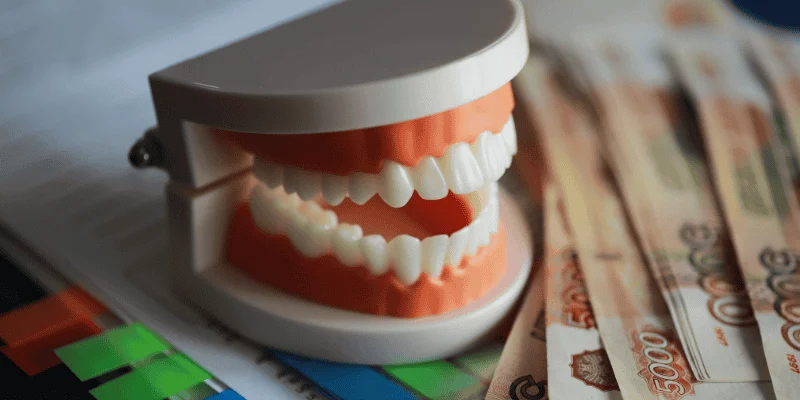 Dental Implants Cost Analysis