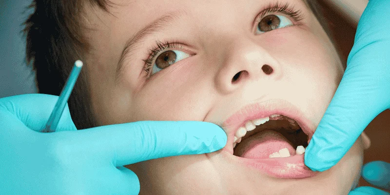 baby tooth not falling out when to see dentist