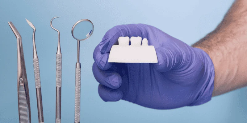 dental crown fell off emergency (1)