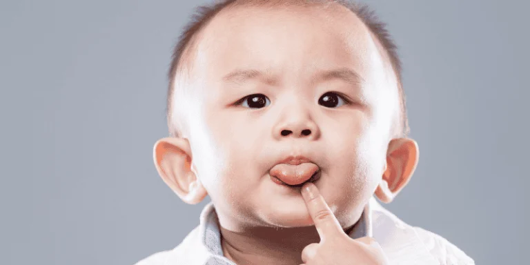 tongue-tie-frenectomy