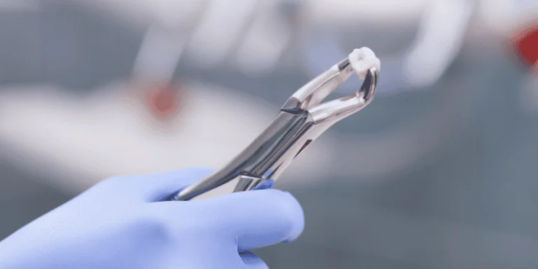 tooth extraction vs root canal decision
