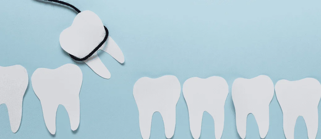 dry socket after tooth extraction